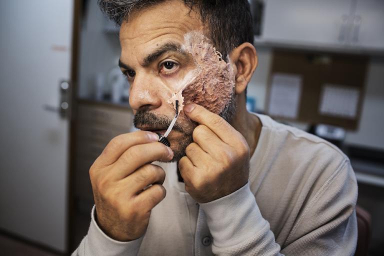 Kanterna på masken får ett extra lagar lim